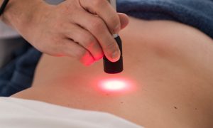 Laser infravermelho ajuda a combater gordura no fígado